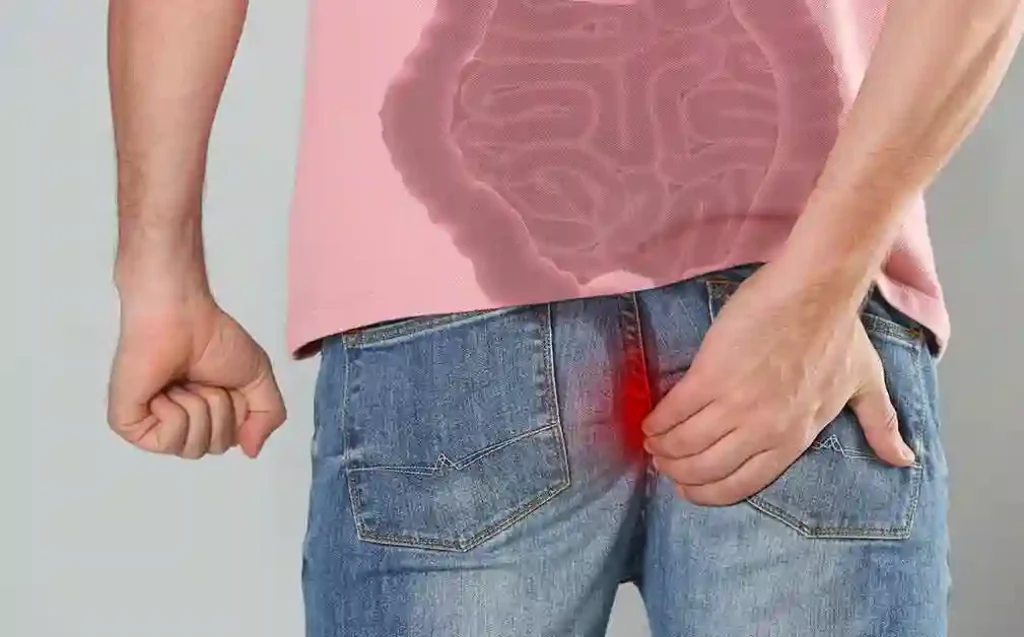 يُمكن استخدام تقنية الليزر في علاج جميع حالات الناسور الشرجي